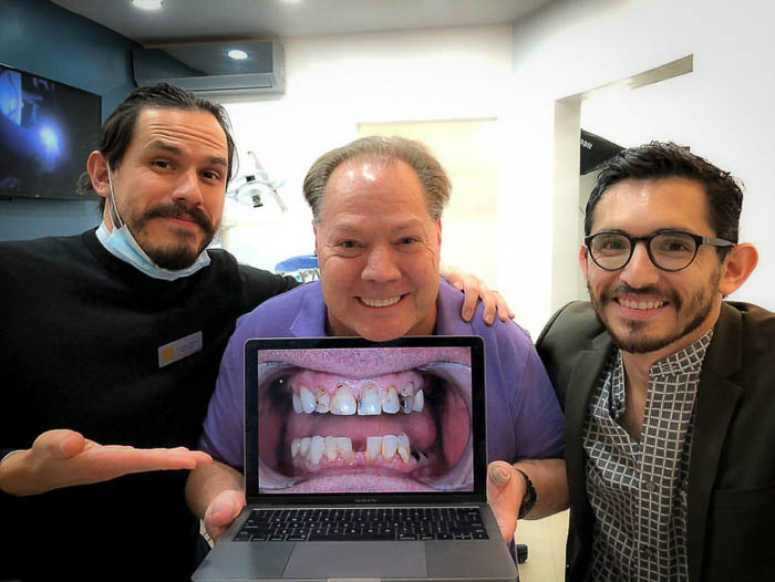 The patient and the dentists smile after a successful fixed denture procedure in Mexico.